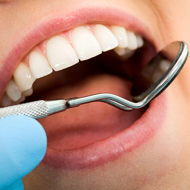 بهبودی کامل پس از کشیدن دندان عقل چه مدتی طول می‌کشد؟