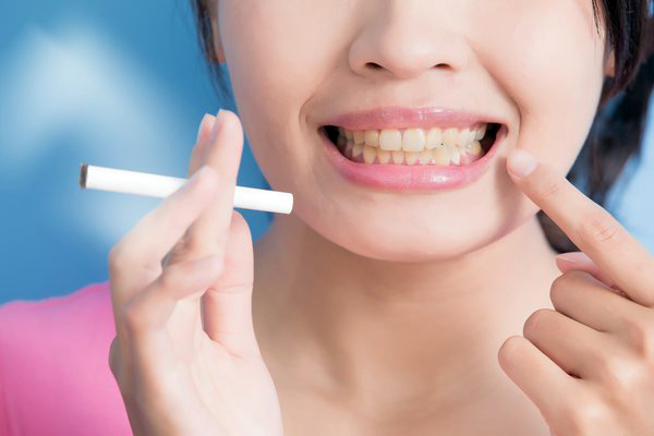 تاثیر سیکار بر سلامت دندان