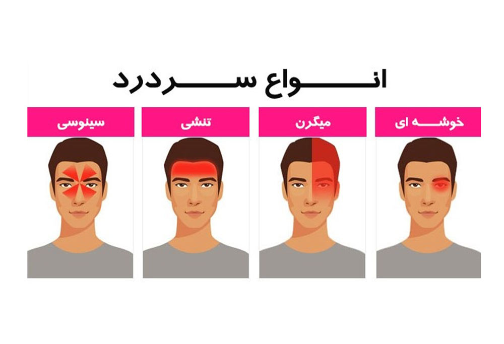  انواع سر دردها