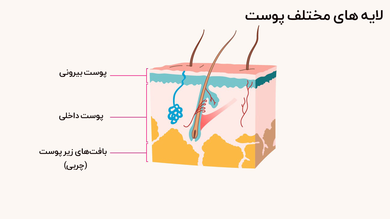 چه چیزی باعث سرطان پوست می‌شود