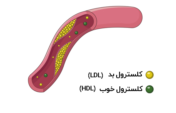 انواع کلسترول خون