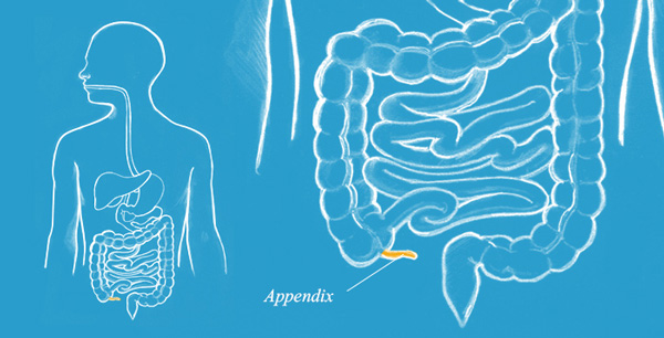 آپاندیس چیست