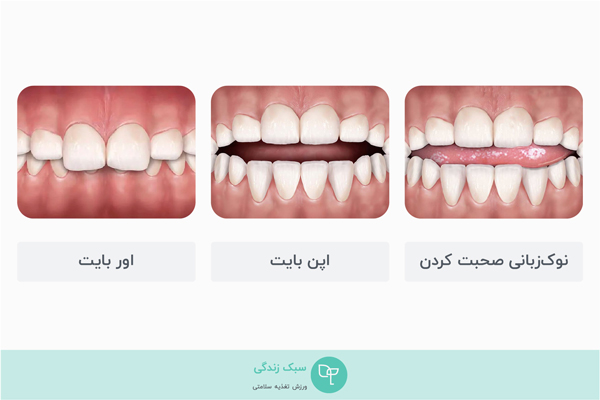 اثرات مکیدن انگشت بر دندان‌ها